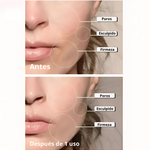 MASAJEADOR FACIAL LED